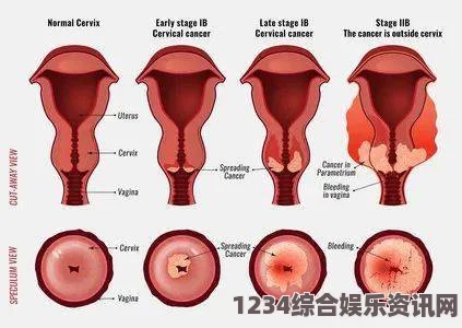 始基子宫治疗的最佳年龄段是什么时候？治疗效果如何评估？